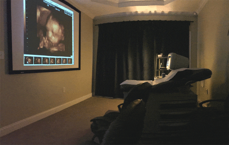 ultrasound theater