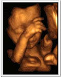 3d ultrasound picture