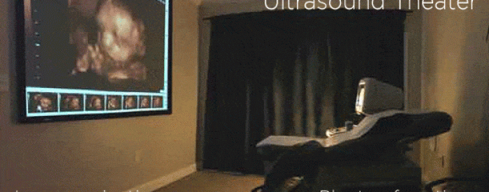 large ultrasound screen